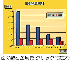 歯の数と治療費（クリックで拡大）